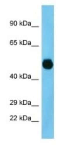 FLJ40125 Rabbit anti-Human, Polyclonal, Novus Biologicals 100 &mu;g; Unconjugated:Antibodies,